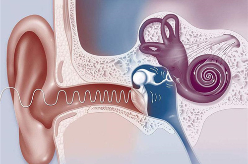 1733296584439576.jpg 人工耳蜗.jpg