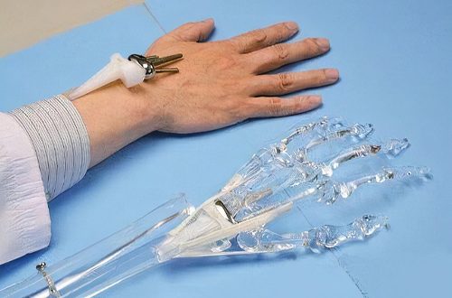 1733296601794254.jpg 人工关节 1.jpg